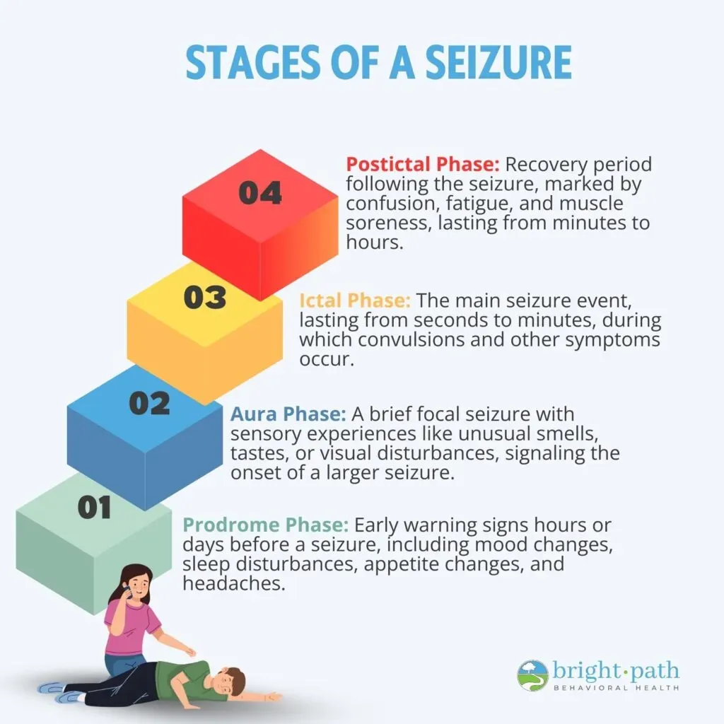 Diagram illustrating the four distinct stages of a typical seizure episode